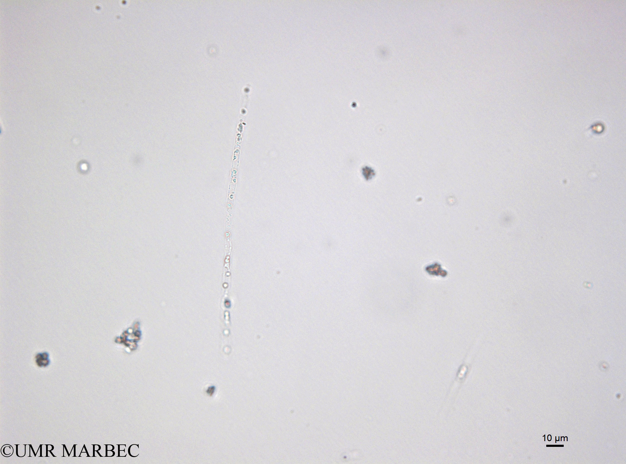 phyto/Bizerte/bizerte_bay/RISCO April 2014/Leptocylindrus minimus (141216_001_ovl)(copy).jpg